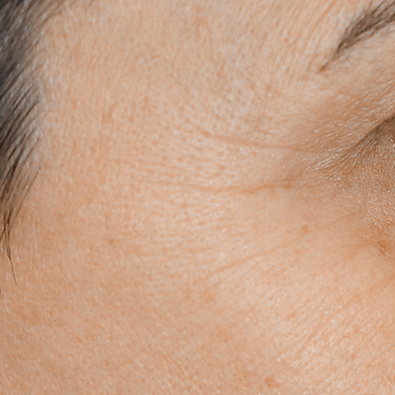 INTENSE HYDRATION - After