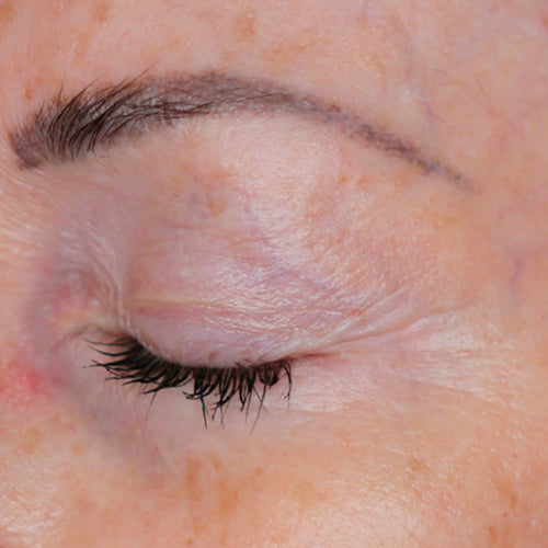 COMPLEXE TENSEUR YEUX - After