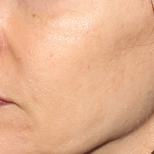 ACIDE GLYCOLIQUE NUIT 10% - After
