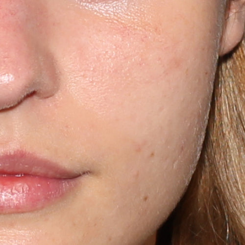 GLYCOLIC ACID NIGHT 5% - After