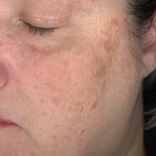 HQ CORRECT 2% - After