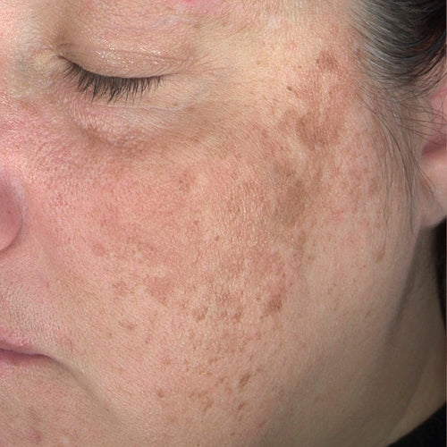 HQ CORRECT 2% - Before