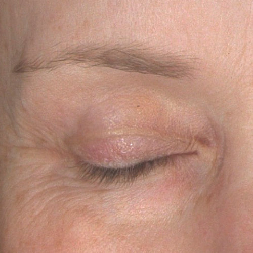 PRE/POST-TREATMENT 2 - After