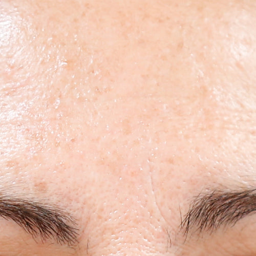 RETINOL 0,5% - After