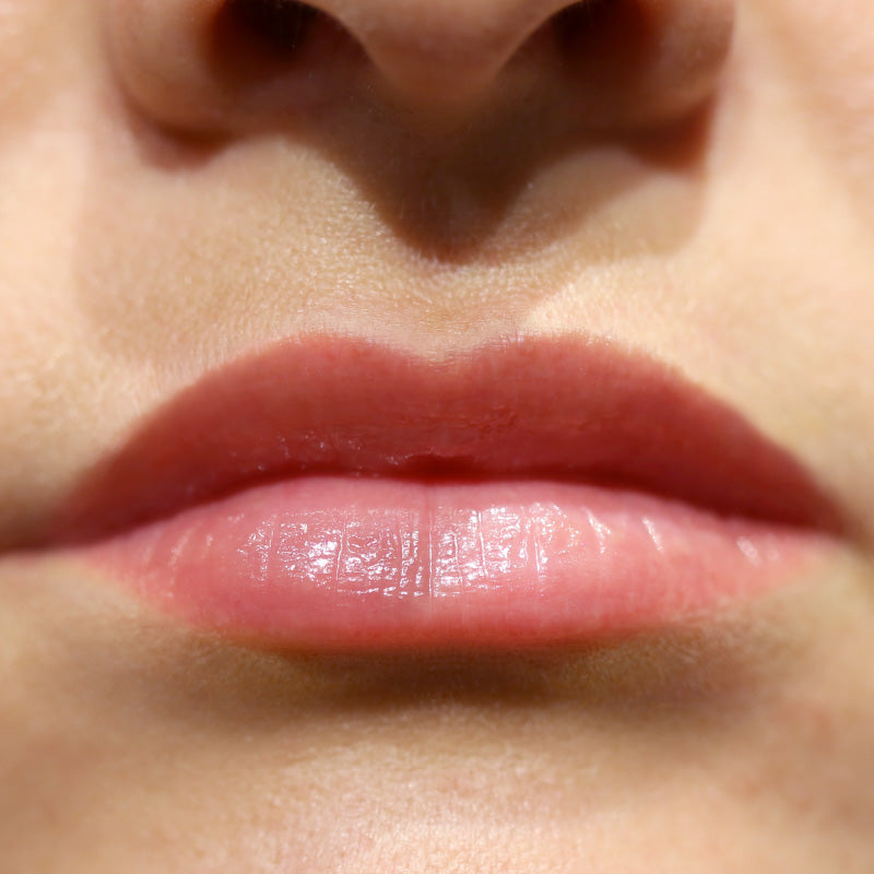 COLLAGEN INFUSION - After