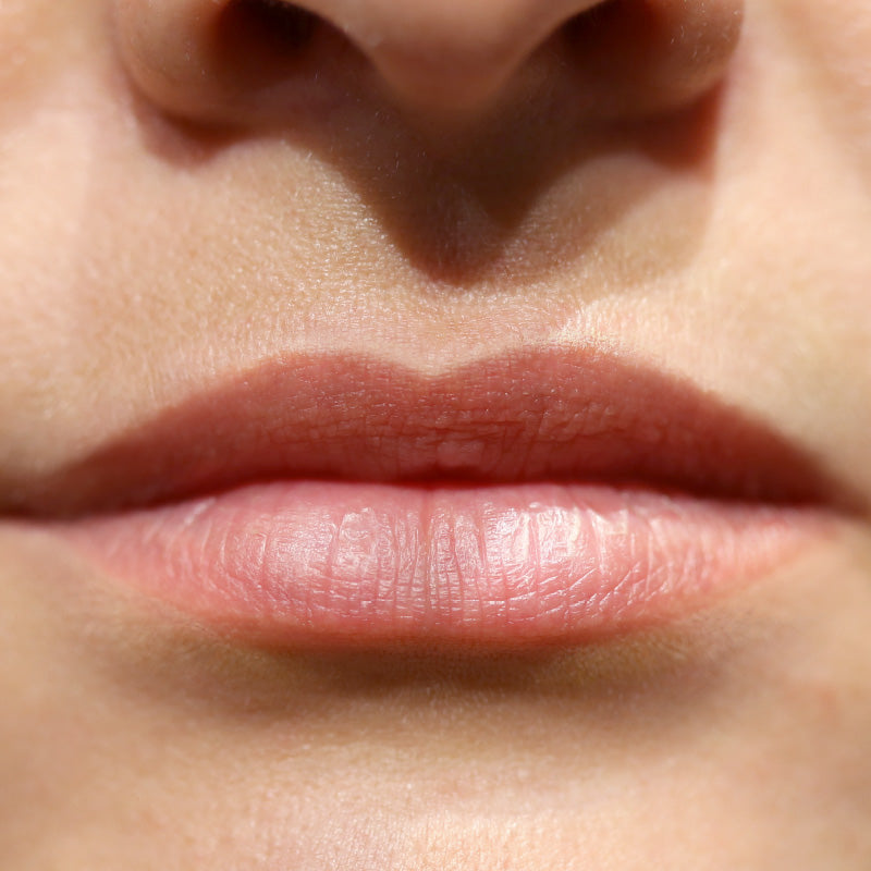 COLLAGEN INFUSION - Before