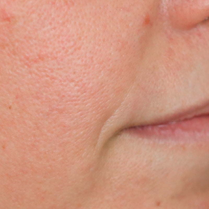 SOLUTION JEUNESSE - After