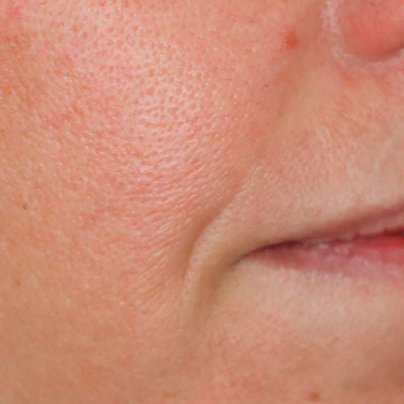 SOLUTION JEUNESSE - Before