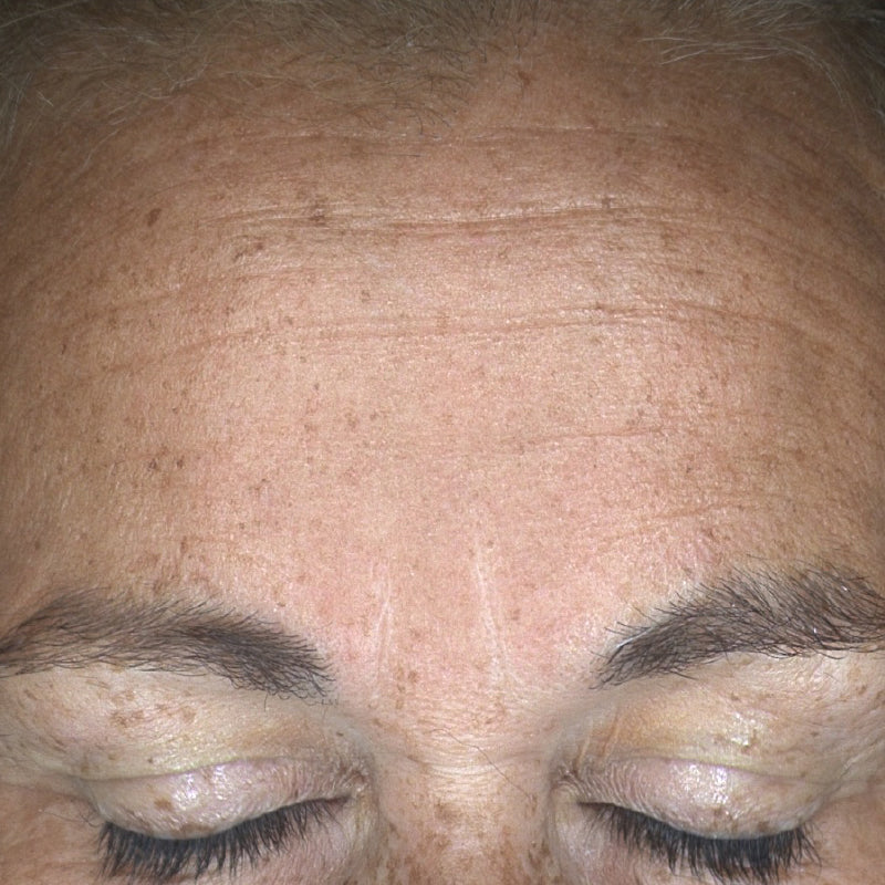INTENSE HYDRATION REFILL - Before